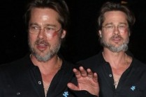 Brad Pitt bruised and battered with mystery injuries as he talks at autism event in Hollywood