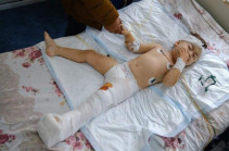 Раненный в Карабахе 2-летний мальчик прооперирован, его жизни не угрожает опасность