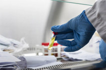 В Арцахе выявили 5 случаев заражения коронавирусом