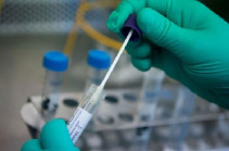 В Арцахе выявлено 37 случаев заражения коронавирусом, зарегистрирован один случай смерти