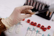 В Арцахе выявлено 68 случаев заражения коронавирусом