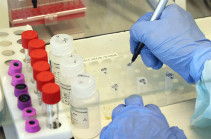 В Арцахе выявлено 25 новых случаев заражения коронавирусом