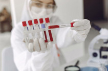 В Арцахе подтверждено 6 новых случаев заражения коронавирусом