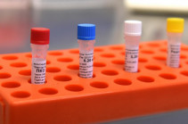 В Арцахе подтверждено 10 новых случаев заражения коронавирусом