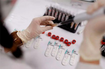 В Арцахе подтверждено 5 новых случаев заражения коронавирусом