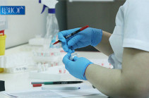 В Армении число зараженных коронавирусом увеличилось на 21, скончались 4 человека