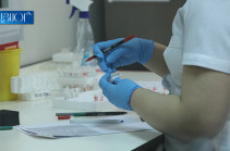 В Армении число зараженных коронавирусом увеличилось на 16, скончались 2 человека