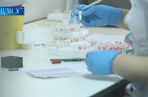 В Армении выявлено 9 новых случаев заражения коронавирусом