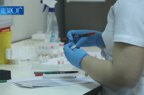 Հայաստանում հաստատվել է կորոնավիրուսային հիվանդության 3 նոր դեպք