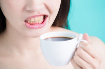 Ինչպե՞ս ճիշտ խմել սուրճը, որպեսզի ատամները չվնասվեն
