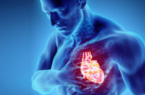 Սրտային անբավարարություն. ախտանշանները, ախտորոշումը, բուժումը