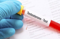 Տեստոստերոն հորմոնի մակարդակը որոշող թեստ․ Ինչպե՞ս և ո՞ր ցուցումների դեպքում հանձնել