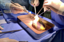 Բացառիկ վիրահատություն. ՄԻԱՎ վարակով պացիենտի սիրտը  կփոխպատվաստեն