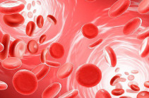 Արյան սպիտակուցի ընդհանուր հետազոտություն․ Ո՞ր դեպքերում է անհրաժեշտ  կենսանմուշ  հանձնել