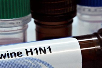 В Армении вируса H1N1 не зарегистрировано