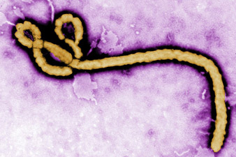 Japanese researchers develop 30-minute Ebola test