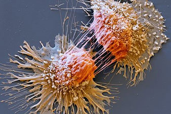 Cancer gene test 'would save lives'
