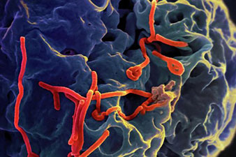 Франция выделит на борьбу с лихорадкой Эбола 100 млн евро