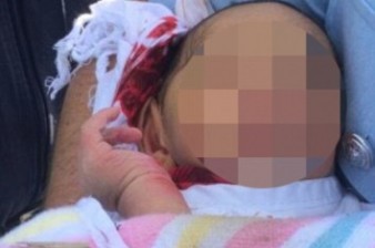 В Австралии новорожденный пять дней пролежал в канаве под бетонной плитой