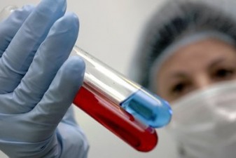 Академик Покровский: Вакцина от СПИДа появится не скоро