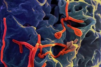 Ebola vaccine 'promising,' say scientists after human trial