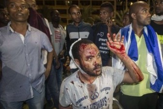 Israeli Ethiopian protests 'reveal open wound', president says