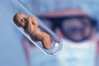 В пробирке впервые вырастили двухнедельный человеческий эмбрион