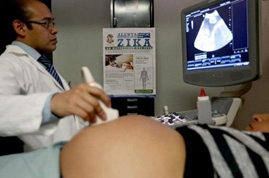 Число беременных американок с признаками Зика достигло 400
