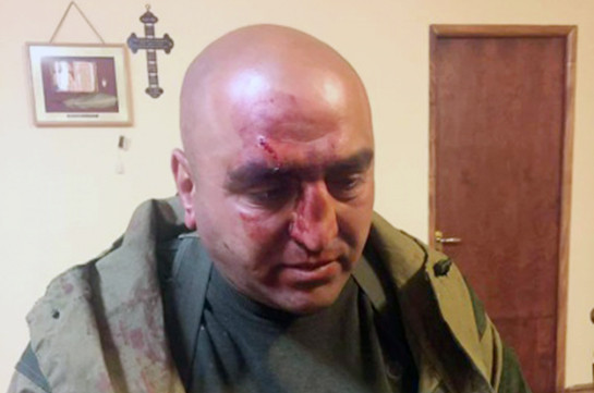 Совершивший вооруженное нападение на сторонников Пашиняна «Монах» задержан