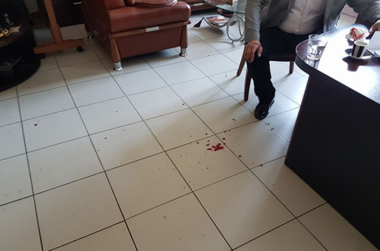 В Ереване совершено нападение на адвокатов Тиграна Атанесяна и Армена Согомоняна