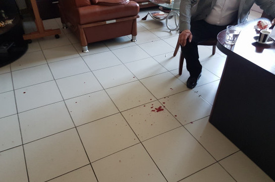 Сотрудники полиции проводят следственные мероприятия в офисе избитого адвоката Атанесяна