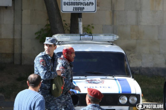 В больницах Еревана остаются 12 пострадавших в результате столкновений полиции и демонстрантов