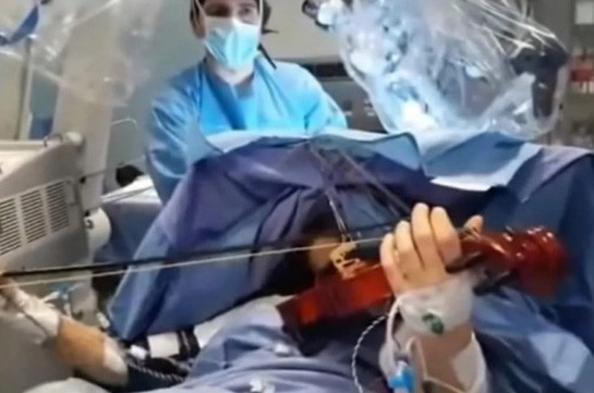 В Италии пациентка играла на скрипке во время операции на головном мозге