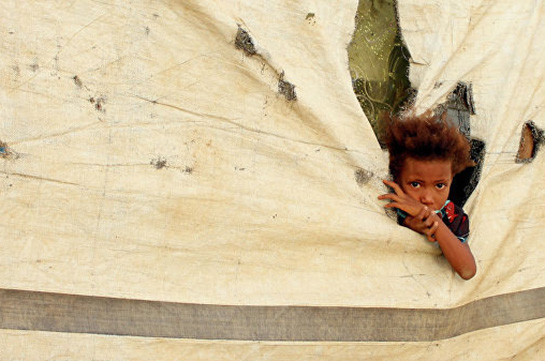 Болезни и голод за годы войны в Йемене унесли жизни свыше 700 тысяч человек