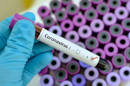 No cases of coronavirus registered in Artsakh