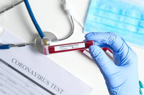 Two suspected coronavirus cases test negative in Artsakh