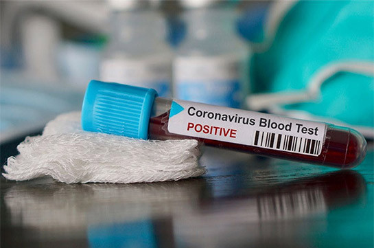 В Грузии коронавирус выявлен у 12 человек