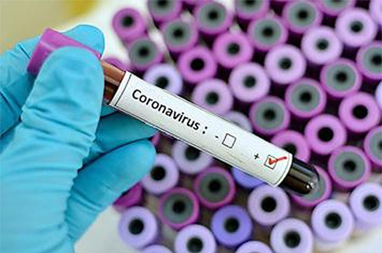 Հայաստանում կորոնավիրուսի 2 նոր դեպք է գրանցվել. ընդհանուր առմամբ վարակված է 8 մարդ. Արսեն Թորոսյան (Տեսանյութ)