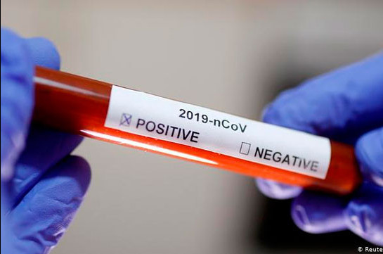 Минздрав Арцаха: В Арцахе нет случаев коронавируса, результаты всех 13 тестов – отрицательные