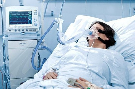 Armenia to receive big number of lung ventilation devices