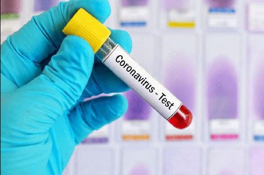 Another doctor, ambulance car driver infected with coronavirus