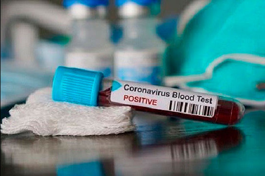 В медицинском центре «Сурб Григор Лусаворич» зарегистрирован случай смерти от коронавируса