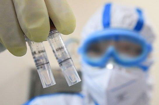 Обнаружено «блокирующее коронавирус на 100 процентов» антитело
