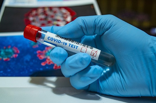 В Армении число зараженных коронавирусом достигло 7113, число смертей – 126