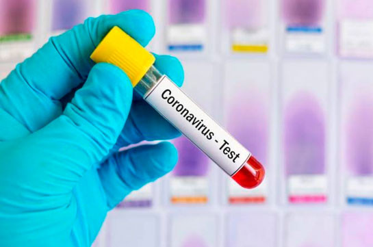 Number of coronavirus cases in Armenia grows by 251 in a day, 10 new deaths reported