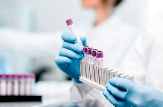В Арцахе подтверждены шесть новых случаев заражении коронавирусом