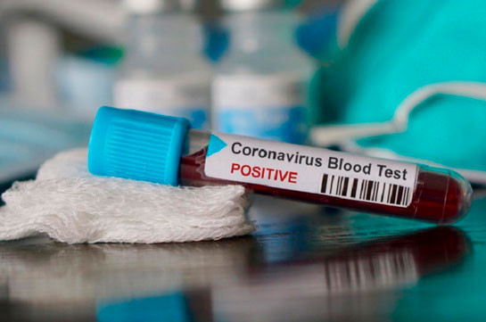 Artsakh records 4 new confirmed coronavirus cases