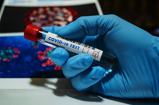 В Арцахе число подтвержденных случаев заражения коронавирусом составляет 129