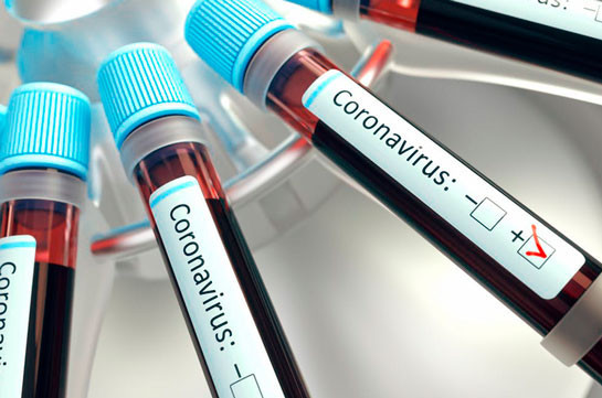 В Арцахе выявлено10 новых случаев заражения коронавирусом