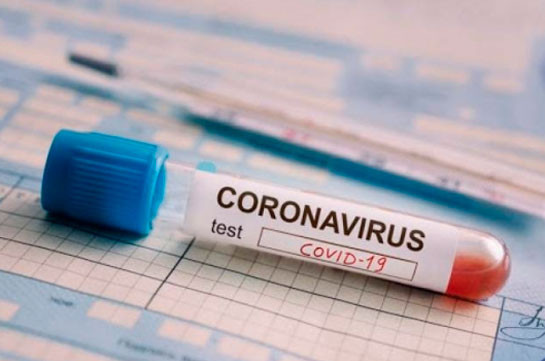 В Арцахе подтверждено два новых случая заражения коронавирусом